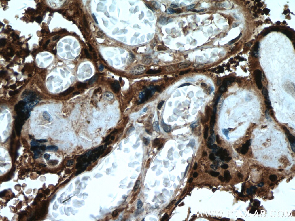 Immunohistochemistry (IHC) staining of human placenta tissue using HSD17B1 Polyclonal antibody (27830-1-AP)