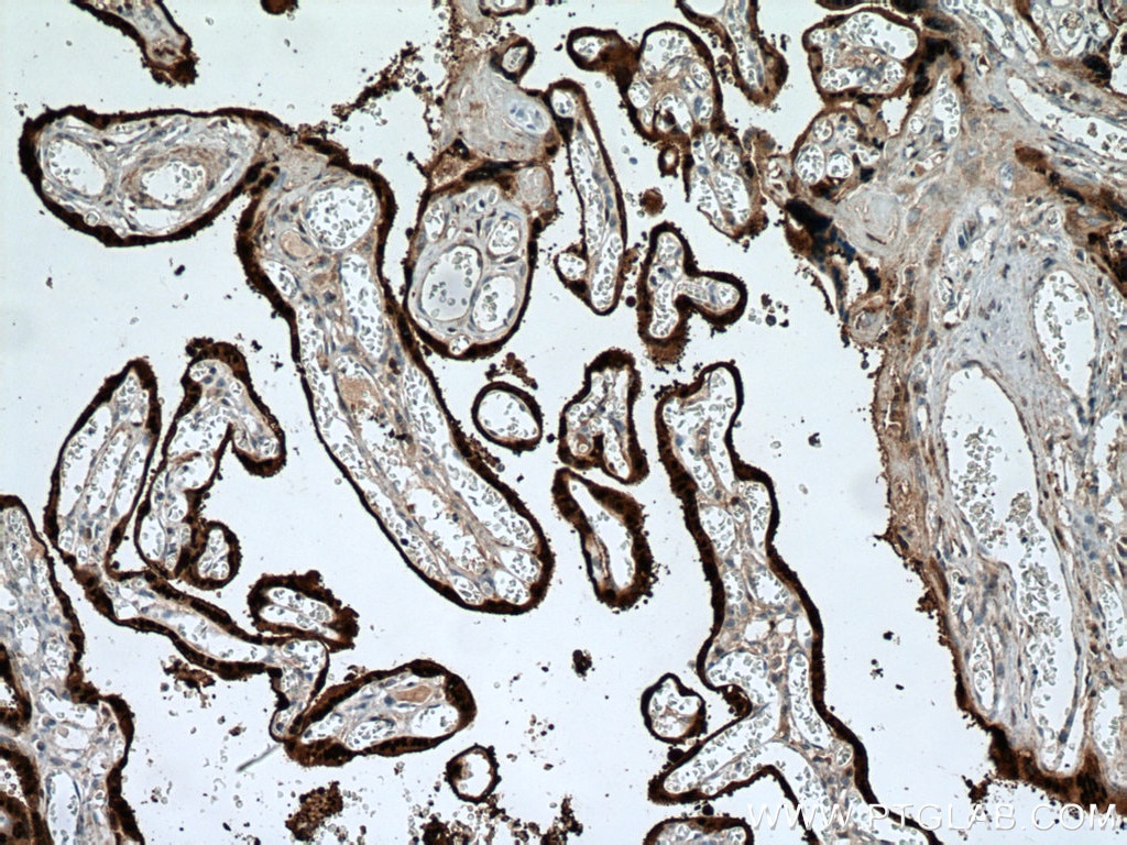 Immunohistochemistry (IHC) staining of human placenta tissue using HSD17B1 Polyclonal antibody (27830-1-AP)