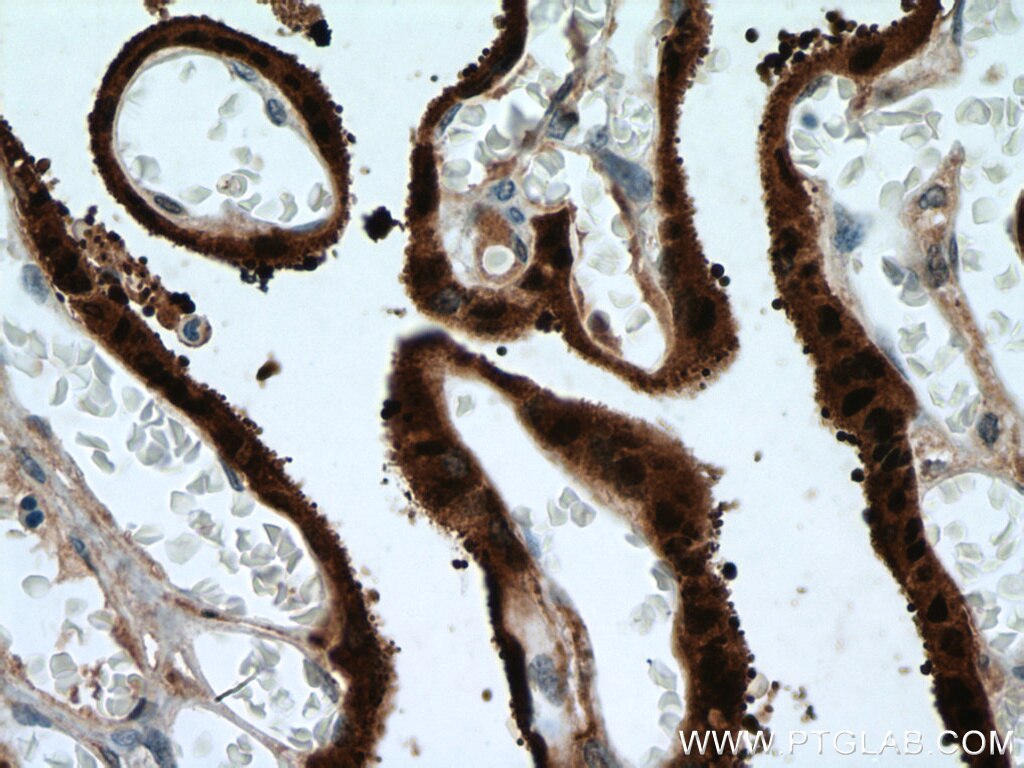 Immunohistochemistry (IHC) staining of human placenta tissue using HSD17B1 Polyclonal antibody (27830-1-AP)