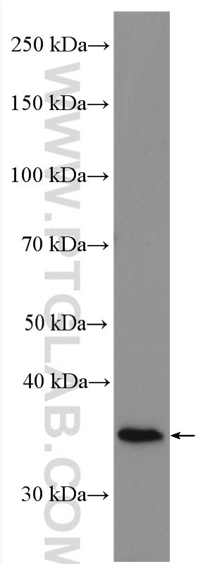 Western Blot (WB) analysis of human placenta tissue using HSD17B1 Polyclonal antibody (27830-1-AP)