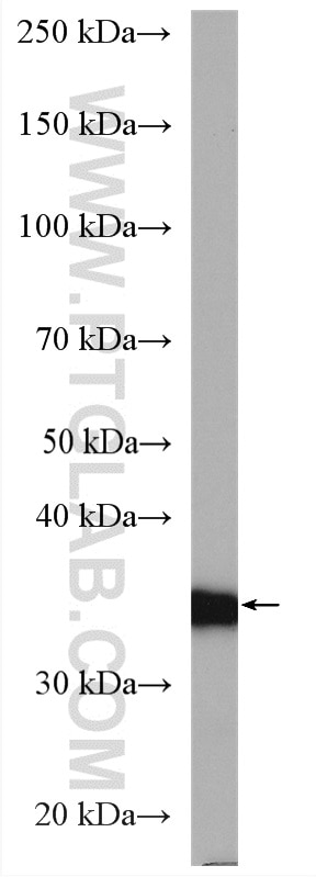 Western Blot (WB) analysis of human placenta tissue using HSD17B1 Polyclonal antibody (27830-1-AP)