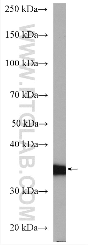 Western Blot (WB) analysis of human placenta tissue using HSD17B1 Polyclonal antibody (27830-1-AP)