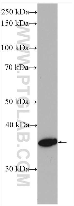Western Blot (WB) analysis of human placenta tissue using HSD17B1 Polyclonal antibody (27830-1-AP)