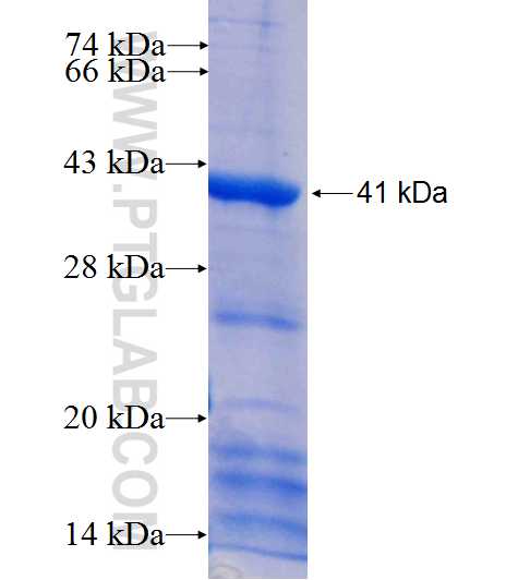 HSD17B1 fusion protein Ag26221 SDS-PAGE