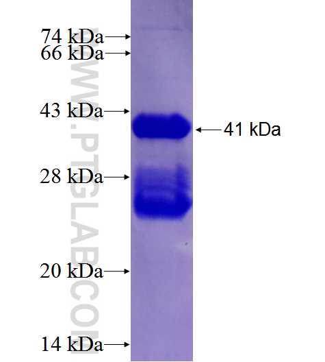 HSD17B1 fusion protein Ag27213 SDS-PAGE