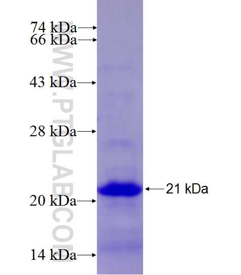 HSD17B1 fusion protein Ag27527 SDS-PAGE