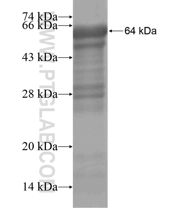 HSD17B1 fusion protein Ag17886 SDS-PAGE