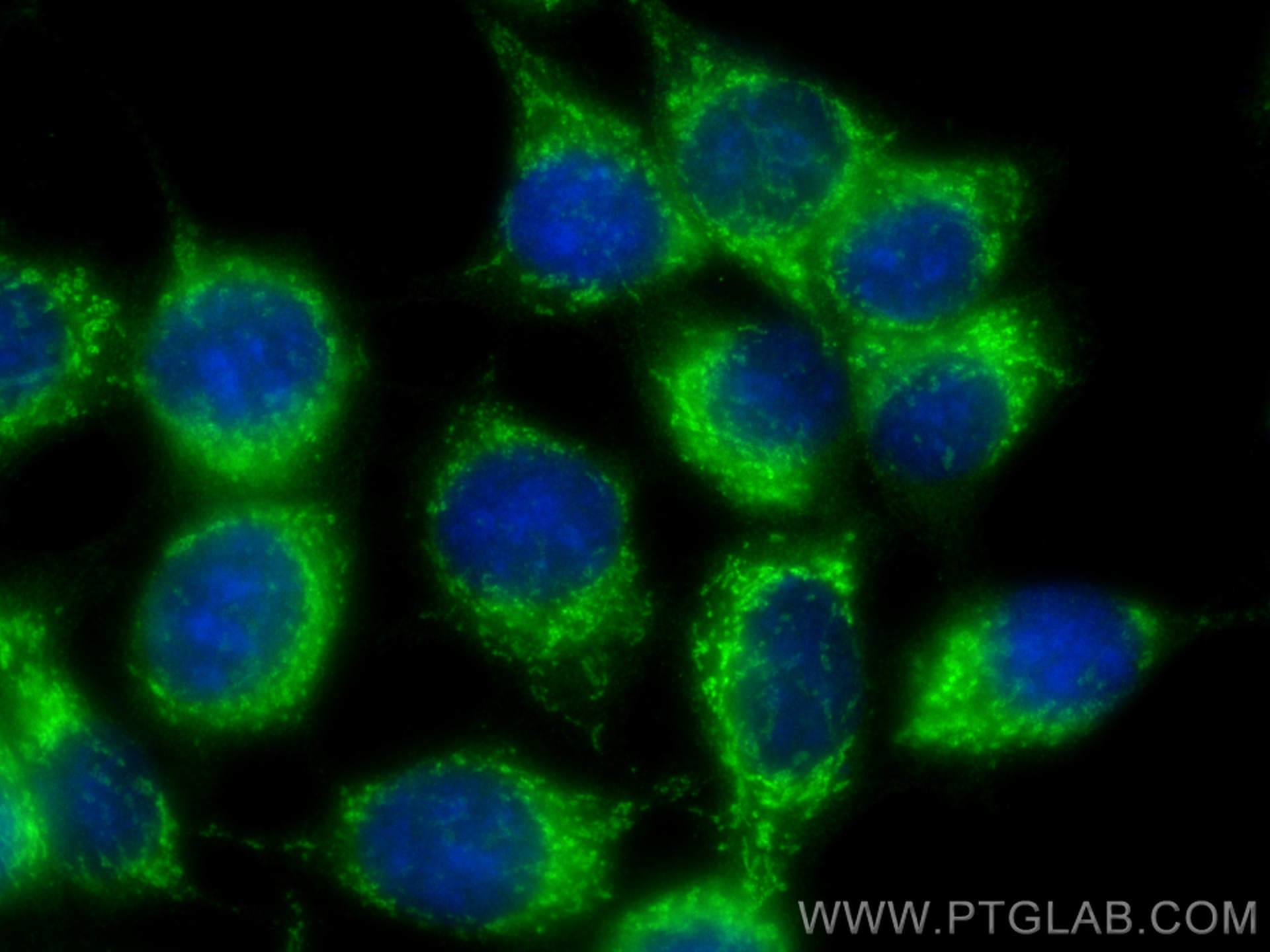 Immunofluorescence (IF) / fluorescent staining of MCF-7 cells using ERAB Polyclonal antibody (10648-1-AP)
