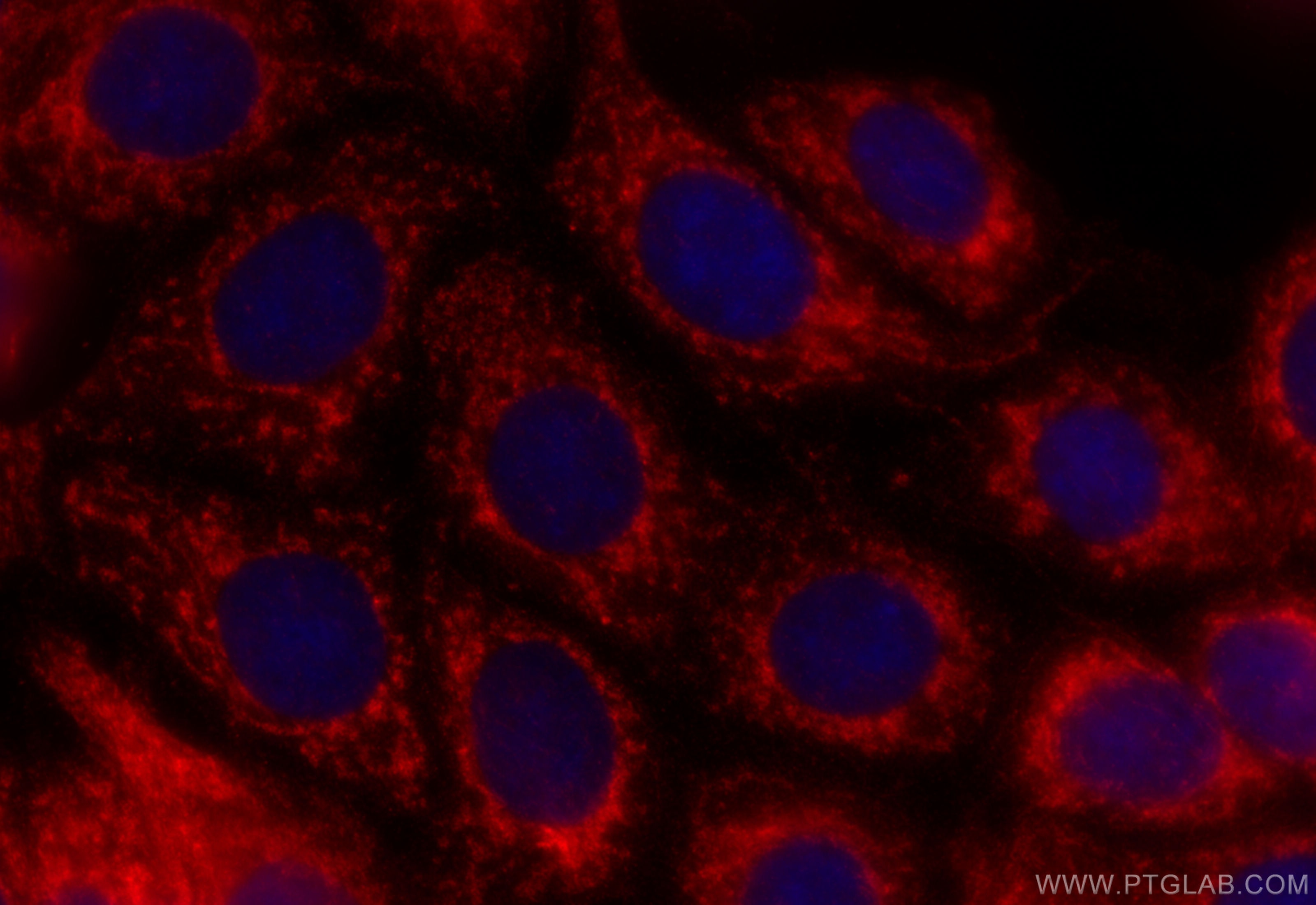 Immunofluorescence (IF) / fluorescent staining of MCF-7 cells using ERAB Polyclonal antibody (10648-1-AP)