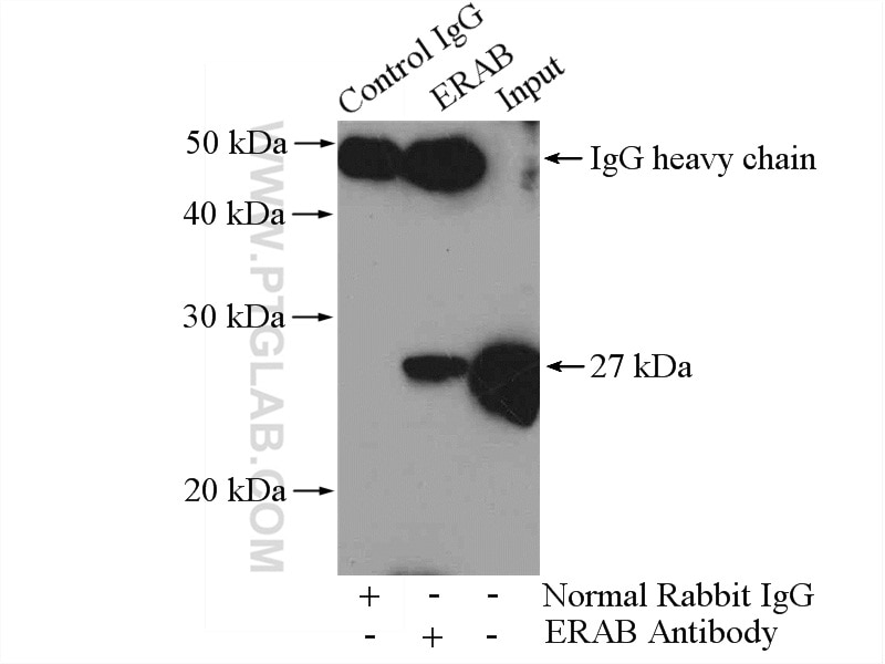 Immunoprecipitation (IP) experiment of HeLa cells using ERAB Polyclonal antibody (10648-1-AP)