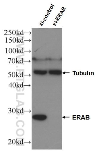 Western Blot (WB) analysis of HEK-293 cells using ERAB Polyclonal antibody (10648-1-AP)