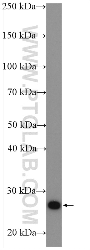 Western Blot (WB) analysis of HeLa cells using ERAB Polyclonal antibody (10648-1-AP)