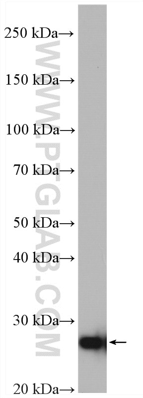 Western Blot (WB) analysis of HEK-293 cells using ERAB Polyclonal antibody (10648-1-AP)