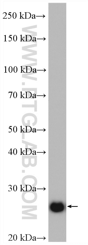 Western Blot (WB) analysis of HeLa cells using ERAB Polyclonal antibody (10648-1-AP)