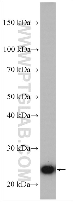 Western Blot (WB) analysis of mouse liver tissue using ERAB Polyclonal antibody (10648-1-AP)