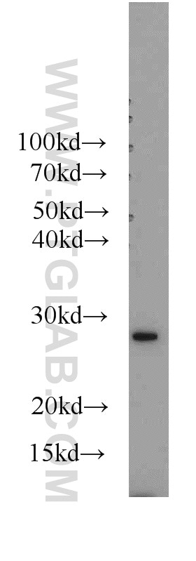 Western Blot (WB) analysis of A2780 cells using ERAB Polyclonal antibody (10648-1-AP)