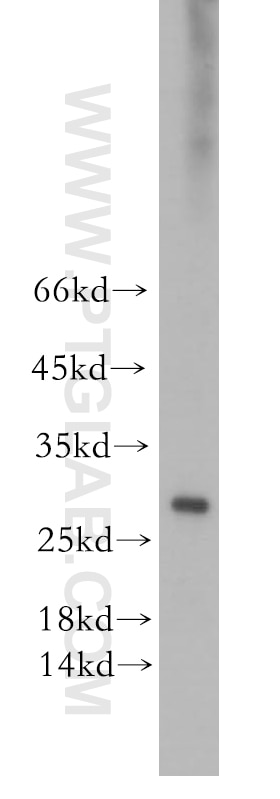 Western Blot (WB) analysis of human brain tissue using ERAB Polyclonal antibody (10648-1-AP)