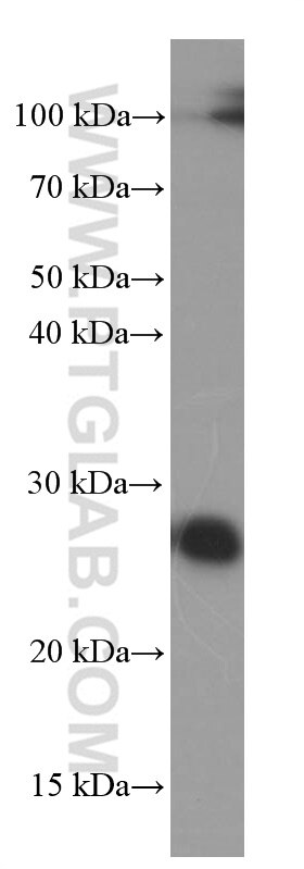 Western Blot (WB) analysis of HEK-293 cells using ERAB Monoclonal antibody (60069-1-Ig)