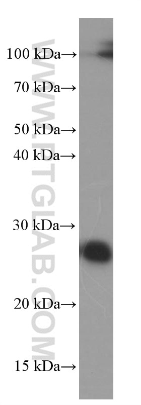 Western Blot (WB) analysis of HEK-293 cells using ERAB Monoclonal antibody (60069-1-Ig)