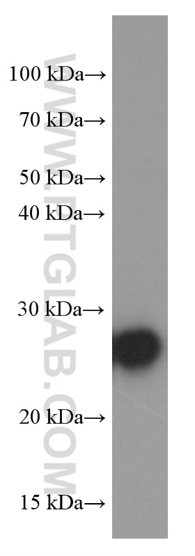 Western Blot (WB) analysis of HeLa cells using ERAB Monoclonal antibody (60069-1-Ig)
