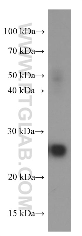 Western Blot (WB) analysis of Jurkat cells using ERAB Monoclonal antibody (60069-1-Ig)