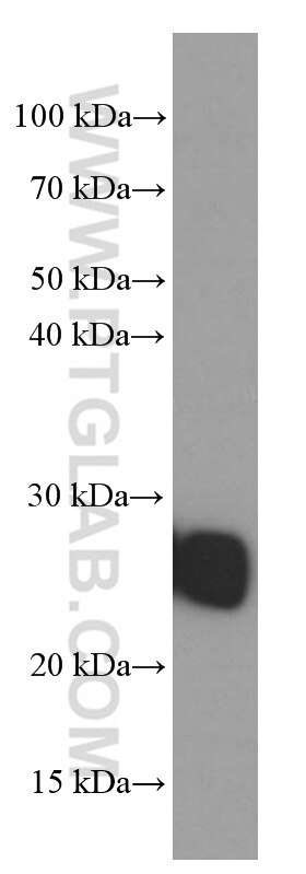 Western Blot (WB) analysis of ROS1728 cells using ERAB Monoclonal antibody (60069-1-Ig)