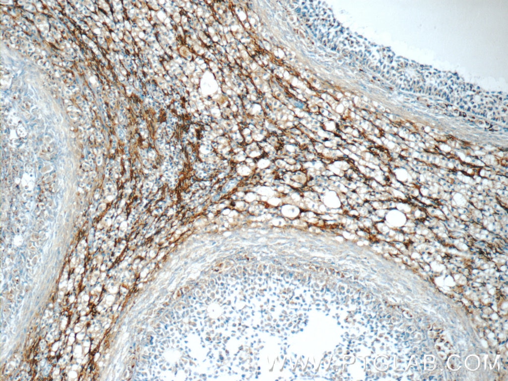Immunohistochemistry (IHC) staining of human ovary tissue using HSD17B11 Polyclonal antibody (16303-1-AP)