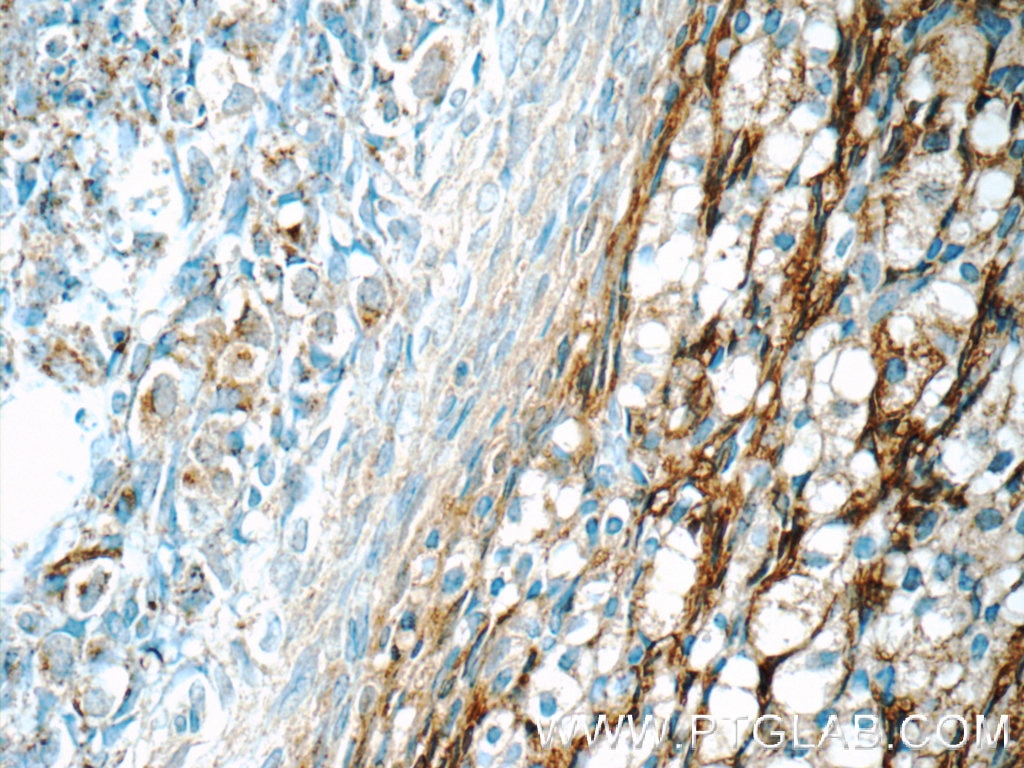 Immunohistochemistry (IHC) staining of human ovary tissue using HSD17B11 Polyclonal antibody (16303-1-AP)