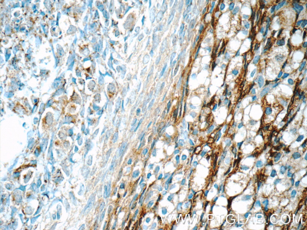 IHC staining of human ovary using 16303-1-AP