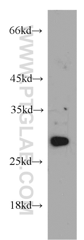 Western Blot (WB) analysis of mouse liver tissue using HSD17B11 Polyclonal antibody (16303-1-AP)