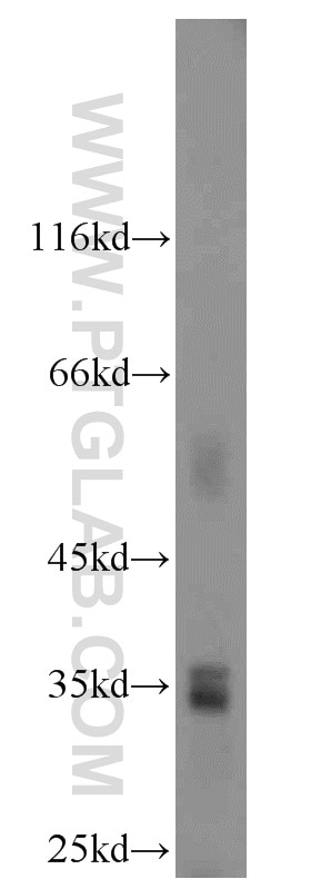 Western Blot (WB) analysis of L02 cells using HSD17B11 Polyclonal antibody (16303-1-AP)