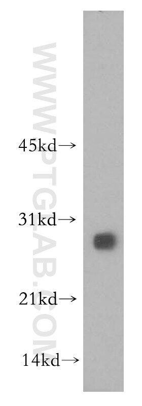Western Blot (WB) analysis of mouse liver tissue using HSD17B11 Polyclonal antibody (16303-1-AP)