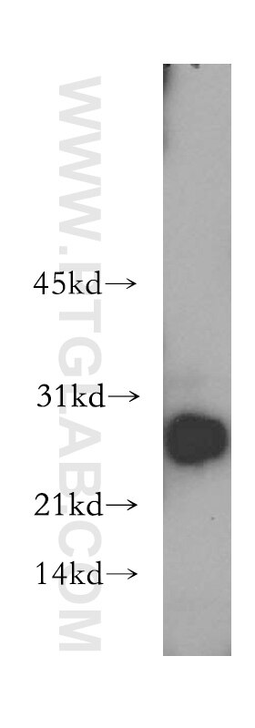 Western Blot (WB) analysis of mouse heart tissue using HSD17B11 Polyclonal antibody (16303-1-AP)