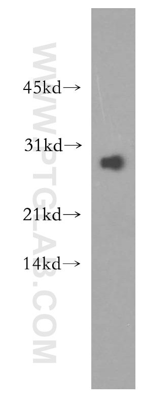 Western Blot (WB) analysis of mouse lung tissue using HSD17B11 Polyclonal antibody (16303-1-AP)