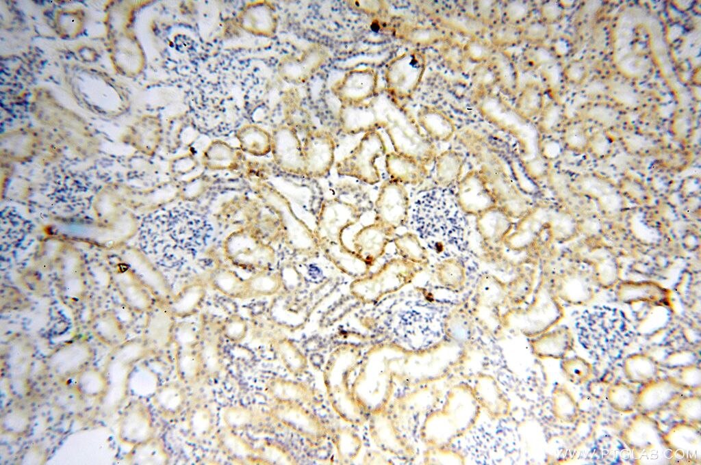 Immunohistochemistry (IHC) staining of human kidney tissue using HSD17B11 Polyclonal antibody (17301-1-AP)