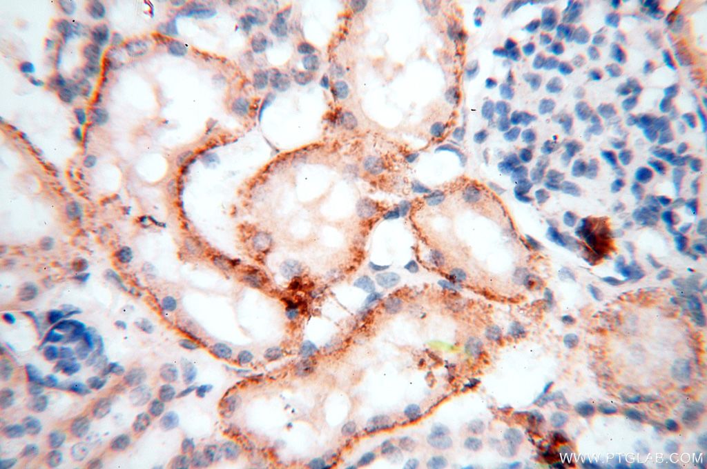 Immunohistochemistry (IHC) staining of human kidney tissue using HSD17B11 Polyclonal antibody (17301-1-AP)
