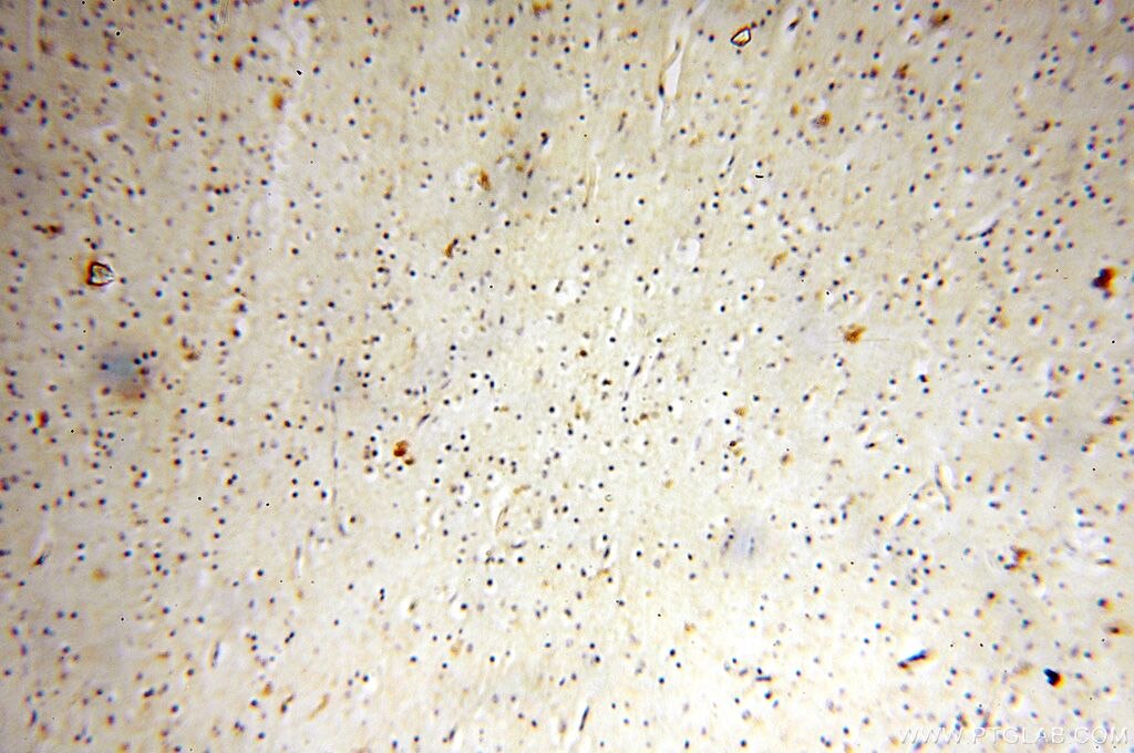 Immunohistochemistry (IHC) staining of human brain tissue using HSD17B11 Polyclonal antibody (17301-1-AP)