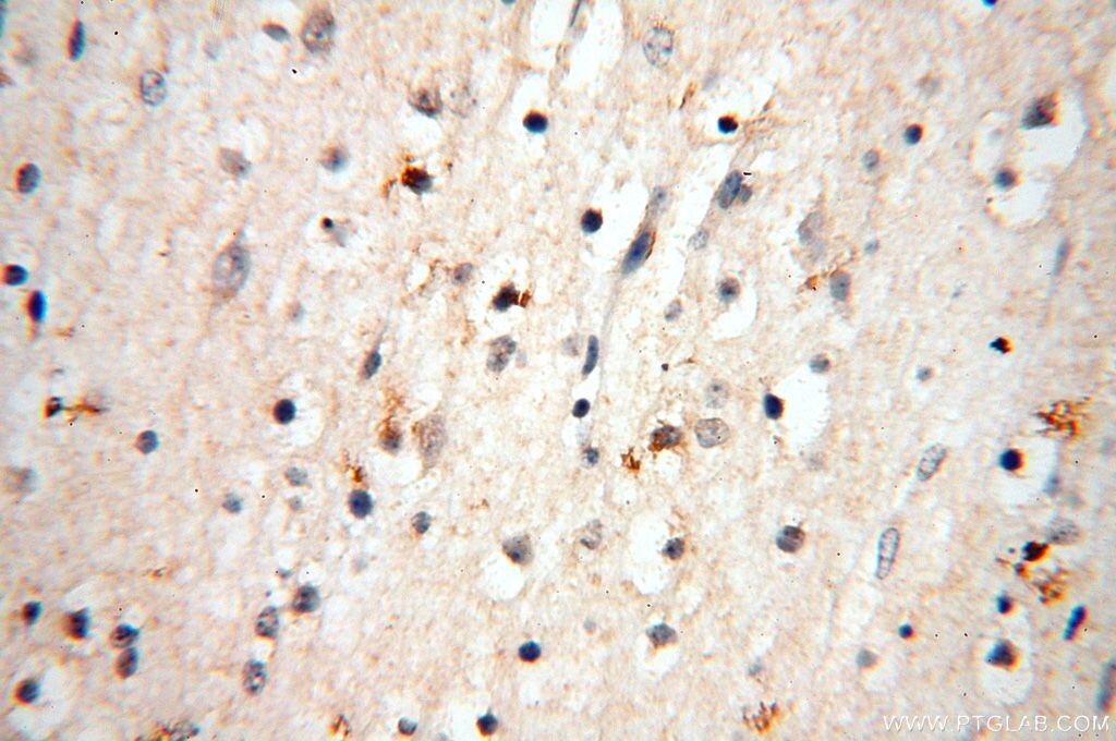 Immunohistochemistry (IHC) staining of human brain tissue using HSD17B11 Polyclonal antibody (17301-1-AP)