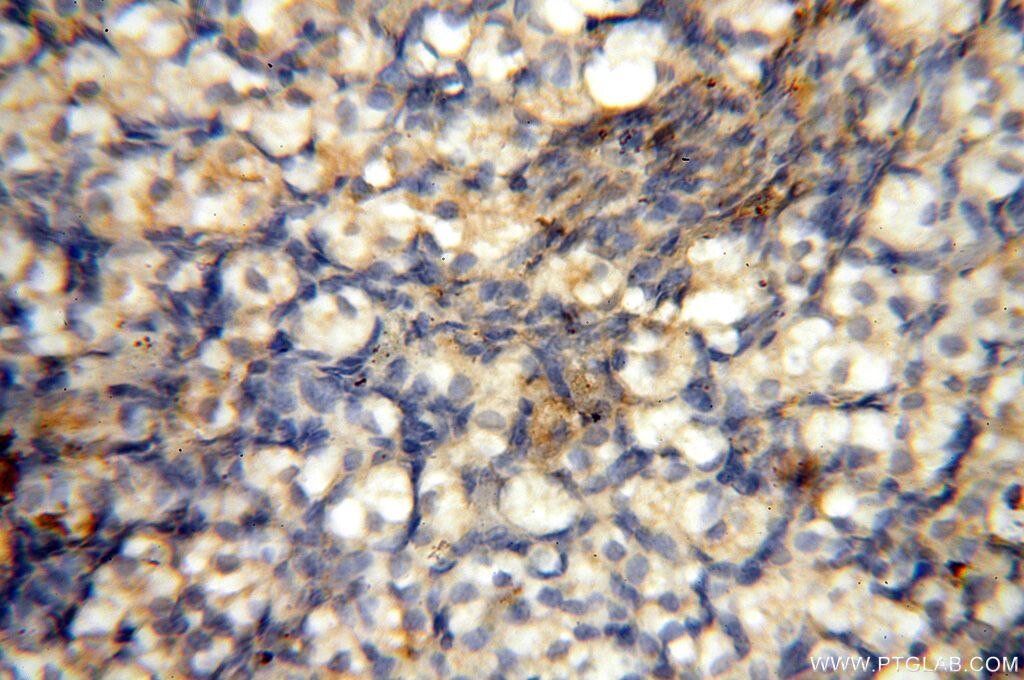 Immunohistochemistry (IHC) staining of human ovary tissue using HSD17B11 Polyclonal antibody (17301-1-AP)