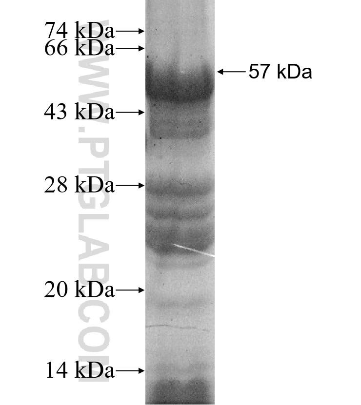 HSD17B11 fusion protein Ag11182 SDS-PAGE