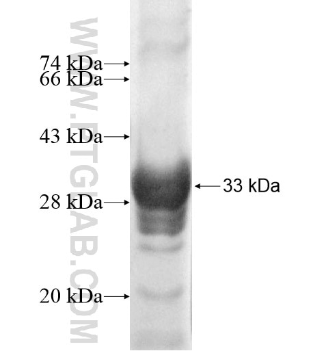 HSD17B11 fusion protein Ag11464 SDS-PAGE