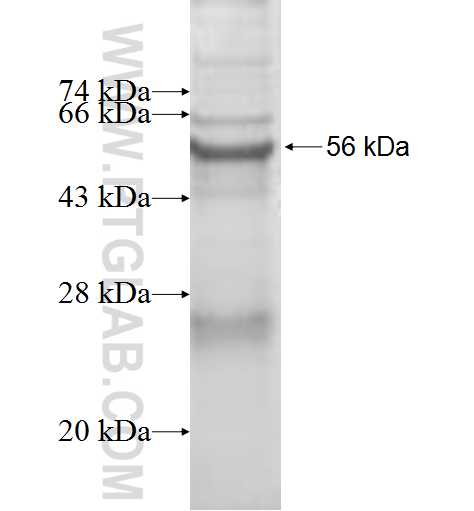 HSD17B11 fusion protein Ag9278 SDS-PAGE