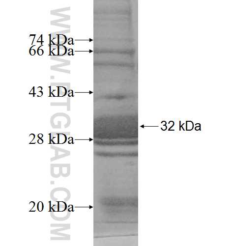 HSD17B11 fusion protein Ag9596 SDS-PAGE