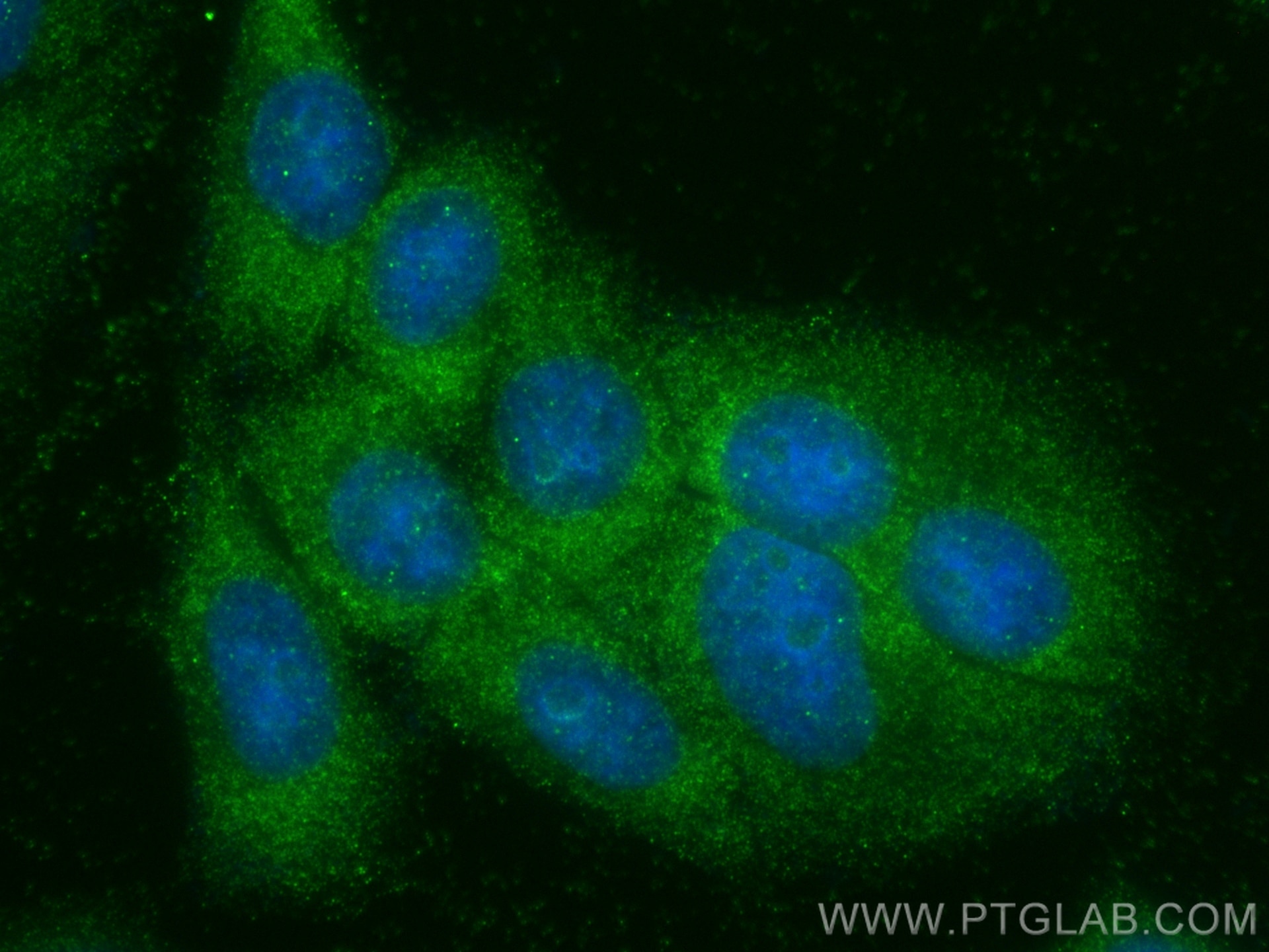 Immunofluorescence (IF) / fluorescent staining of HepG2 cells using HSD17B12 Polyclonal antibody (27461-1-AP)