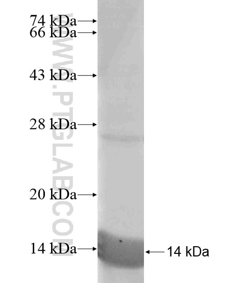 HSD17B13 fusion protein Ag19339 SDS-PAGE