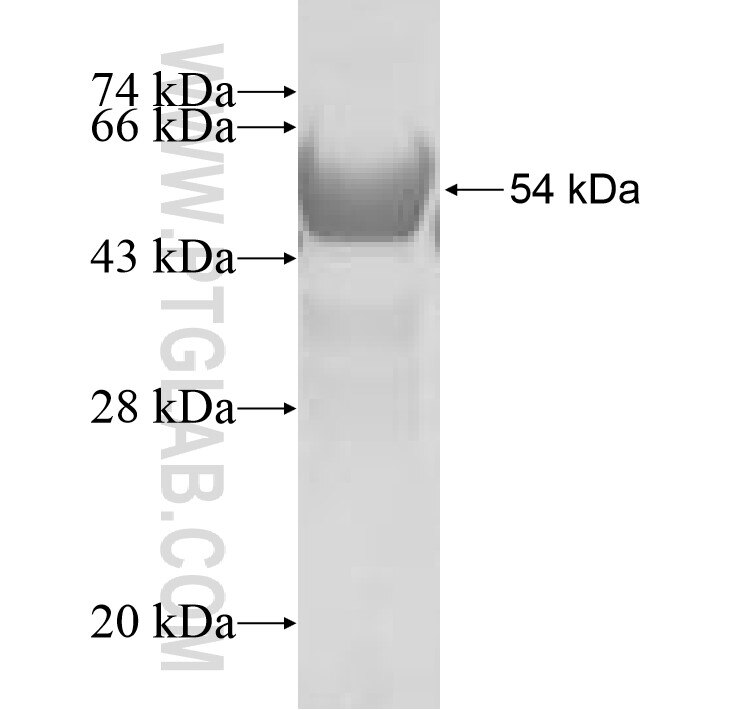 HSD17B14 fusion protein Ag8133 SDS-PAGE