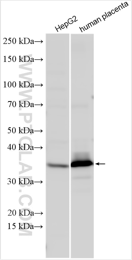 Western Blot (WB) analysis of various lysates using HSD17B2 Polyclonal antibody (10978-1-AP)