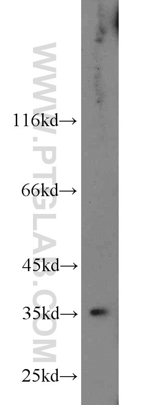 WB analysis of MCF-7 using 10978-1-AP