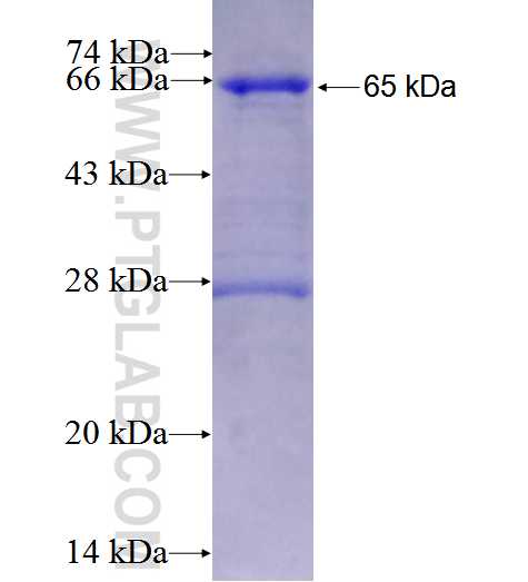 HSD17B2 fusion protein Ag1411 SDS-PAGE
