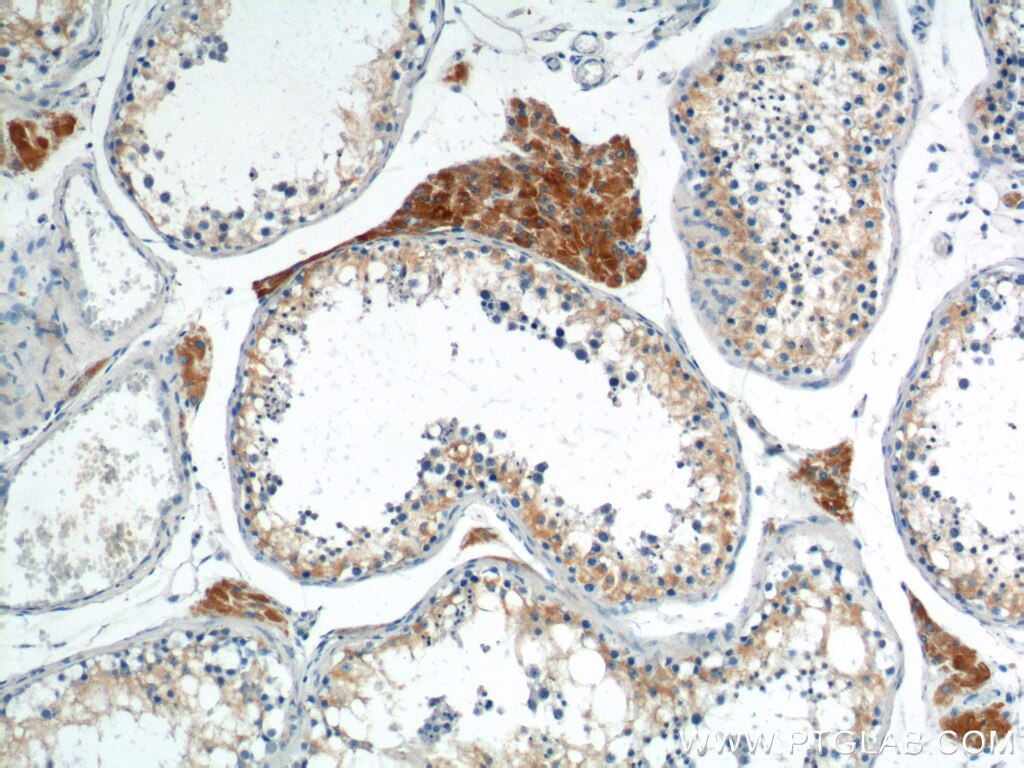 Immunohistochemistry (IHC) staining of human testis tissue using HSD17B3 Polyclonal antibody (13415-1-AP)